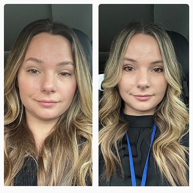 Причины отеков и способы их устранения: что нам нужно знать